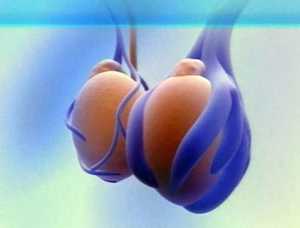 Боль в яичниках причины у мужчин