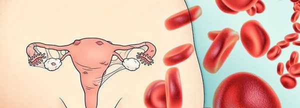 Кровотечение при эндометриозе