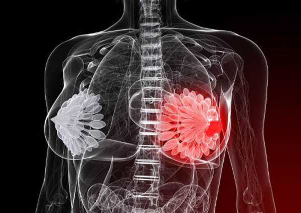 Мастопатия грудных желез симптомы