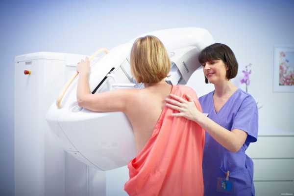 На какой день цикла делают маммографию молочных желез