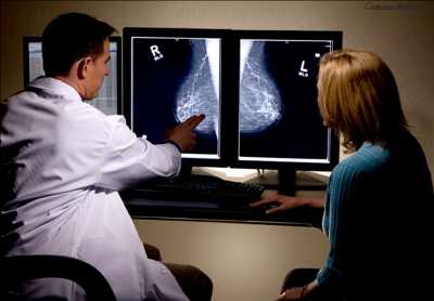 Фиброзно кистозная мастопатия маммография