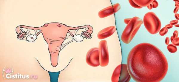 Как остановить маточное кровотечение при эндометриозе